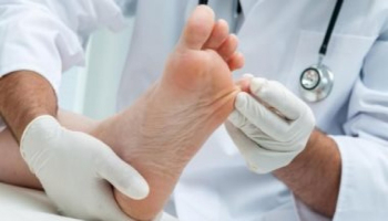 كيف تتجنب الإصابة بالفطريات خلال فصل الصيف