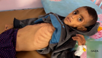 أونروا: المجاعة اجتاحت غزة وأكثر من 100 وفاة بسبب الجوع… والمساعدات الجوية "مجرد ضجة إعلامية"