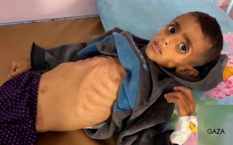 أونروا: المجاعة اجتاحت غزة وأكثر من 100 وفاة بسبب الجوع… والمساعدات الجوية "مجرد ضجة إعلامية"